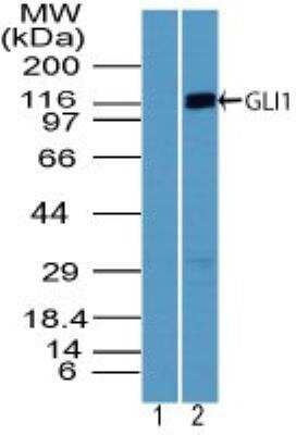 Western Blot: GLI-1 Antibody [NBP2-24662]
