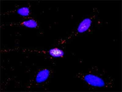 Proximity Ligation Assay: GLI-3 Antibody (2C9) [H00002737-M01]
