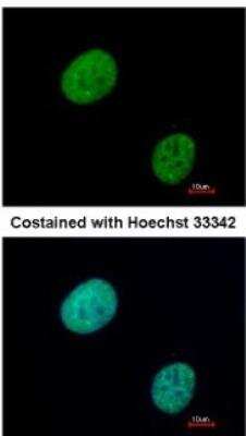 Immunocytochemistry/ Immunofluorescence: GLI-3 Antibody [NBP2-16665]