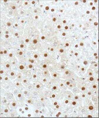 Immunohistochemistry-Paraffin: GLI-3 Antibody - BSA Free [NBP2-29627]