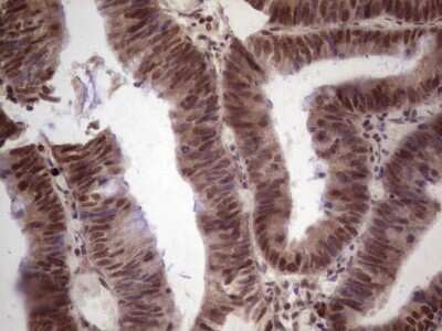 Immunohistochemistry: GLI4 Antibody (OTI3A9) [NBP2-45874]