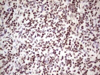 Immunohistochemistry: GLI4 Antibody (OTI3A9) [NBP2-45874]