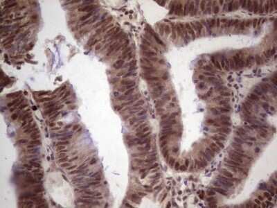 Immunohistochemistry: GLI4 Antibody (OTI3A9) - Azide and BSA Free [NBP2-70833]