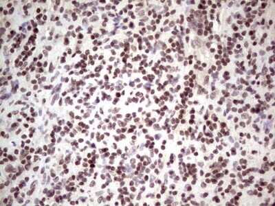 Immunohistochemistry: GLI4 Antibody (OTI3A9) - Azide and BSA Free [NBP2-70833]