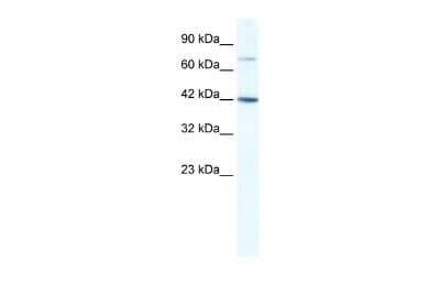 Western Blot: GLI4 Antibody [NBP2-84973]