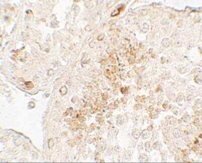 Immunohistochemistry: GLIPR1L1 Antibody - BSA Free [NBP2-81989]