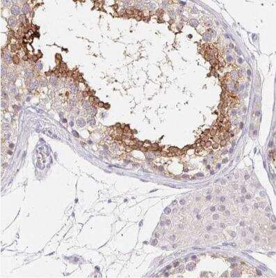 Immunohistochemistry-Paraffin: GLIPR1L1 Antibody [NBP1-82722]