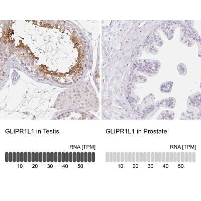 Immunohistochemistry-Paraffin: GLIPR1L1 Antibody [NBP1-82722]