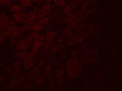 Immunocytochemistry/ Immunofluorescence: GLIPR1L2 Antibody - BSA Free [NBP2-82092]