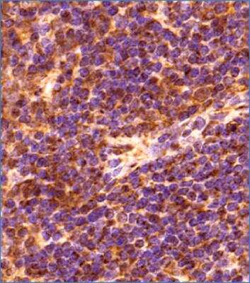 Immunohistochemistry-Paraffin: GLIPR2 Antibody - BSA Free [NBP2-47126]