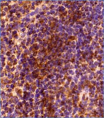 Immunohistochemistry-Paraffin: GLIPR2 Antibody - BSA Free [NBP2-47126]