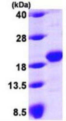 SDS-PAGE: Recombinant Human GLIPR2 His Protein [NBP1-48339]
