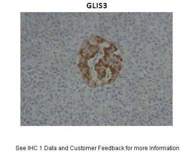 Immunohistochemistry: GLIS3 Antibody [NBP1-80416]