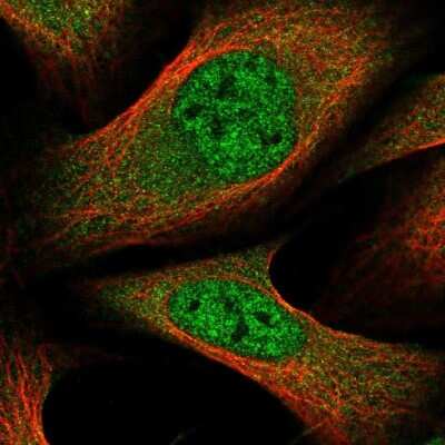 Immunocytochemistry/ Immunofluorescence: GLMN Antibody [NBP2-14054]