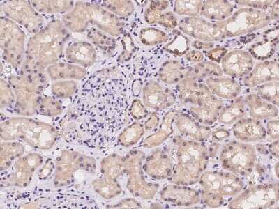 Immunohistochemistry-Paraffin: GLMN Antibody [NBP2-97214]