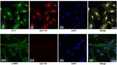Immunocytochemistry: GLP-1R Antibody - BSA Free [NLS1205]