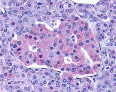 Immunohistochemistry: GLP-1R Antibody - BSA Free [NLS1205]