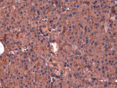 Immunohistochemistry: GLP-1R Antibody - BSA Free [NLS1205]