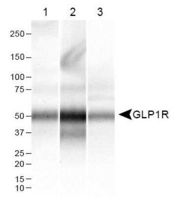 Western Blot: GLP-1R AntibodyBSA Free [NLS1205]
