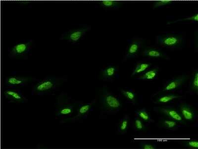 Immunocytochemistry/ Immunofluorescence: GLP/EHMT1 Antibody (1H2) [H00079813-M04]