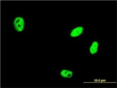 Immunocytochemistry/ Immunofluorescence: GLP/EHMT1 Antibody (3G1) [H00079813-M05]