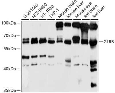 Western Blot: GLRB AntibodyBSA Free [NBP3-04875]