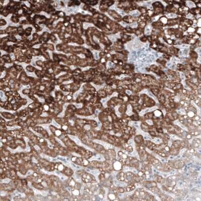 Immunohistochemistry-Paraffin: GLS2 Antibody (CL7716) [NBP2-88907]