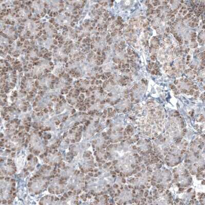 Immunohistochemistry-Paraffin: GLS2 Antibody (CL7716) [NBP2-88907]