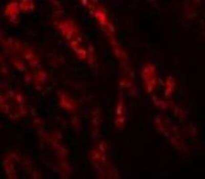 Immunocytochemistry/ Immunofluorescence: GLS2 Antibody - BSA Free [NBP1-76544]