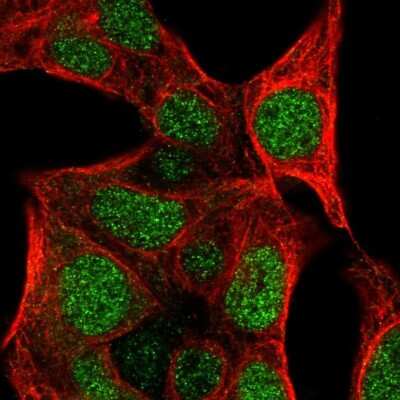 Immunocytochemistry/ Immunofluorescence: GLT25D2 Antibody [NBP1-90712]