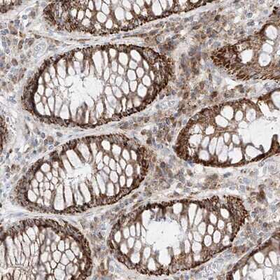 Immunohistochemistry-Paraffin: GLT25D2 Antibody [NBP1-90711]