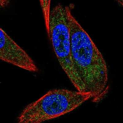 Immunocytochemistry/ Immunofluorescence: GLTP Antibody [NBP2-31642]