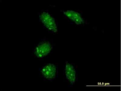 Immunocytochemistry/ Immunofluorescence: GLTSCR2 Antibody [H00029997-B01P]