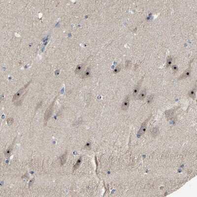 Immunohistochemistry-Paraffin: GLTSCR2 Antibody [NBP1-80905]
