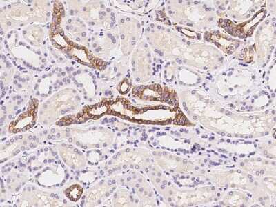 Immunohistochemistry-Paraffin: GLUT10 Antibody [NBP2-98748]