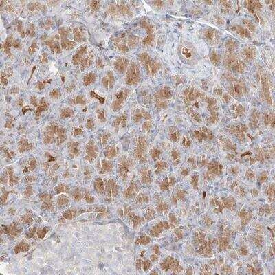 Immunohistochemistry: GLUT12 Antibody [NBP1-91944]
