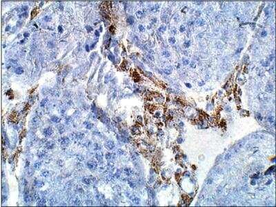 Immunohistochemistry-Paraffin: GLUT12 Antibody [NBP3-12263]