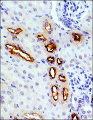 Immunohistochemistry-Paraffin: GLUT9 Antibody [NBP1-06565]