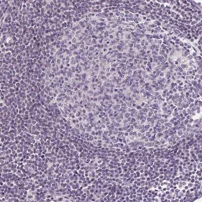 Immunohistochemistry-Paraffin: GLUT9 Antibody [NBP2-47448]