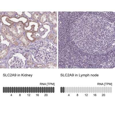Immunohistochemistry-Paraffin: GLUT9 Antibody [NBP2-47448]