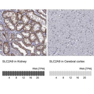 Immunohistochemistry-Paraffin: GLUT9 Antibody [NBP3-16970]