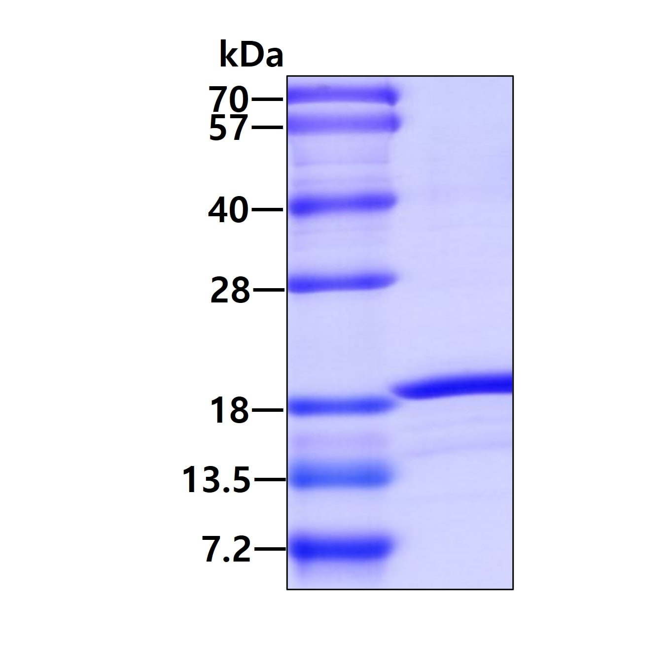 SDS-PAGE: Recombinant Human GLXR5 His Protein [NBP1-44471]