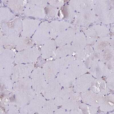 Immunohistochemistry-Paraffin: GLYAT Antibody [NBP2-55298]