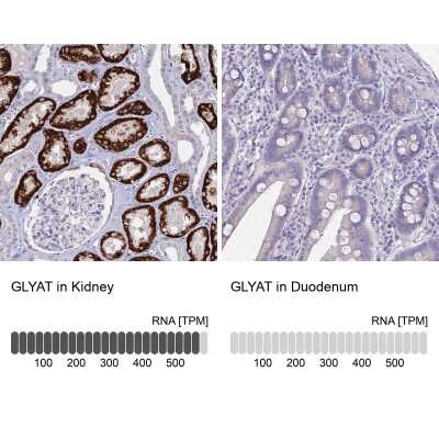 Immunohistochemistry-Paraffin: GLYAT Antibody [NBP2-58917]