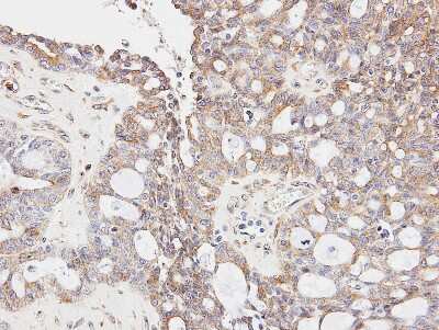 Immunohistochemistry-Paraffin: GLYCTK Antibody [NBP1-32317]