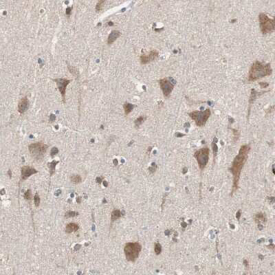 Immunohistochemistry-Paraffin: GLYCTK Antibody [NBP1-83292]