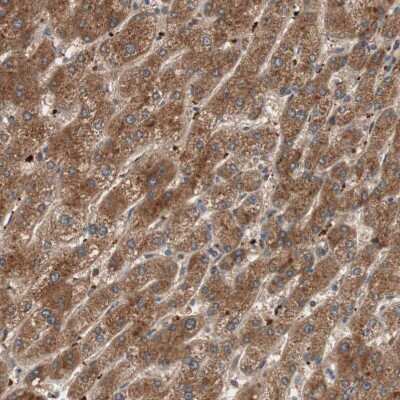 Immunohistochemistry-Paraffin: GLYCTK Antibody [NBP1-83292]