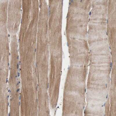 Immunohistochemistry-Paraffin: GLYCTK Antibody [NBP1-83292]