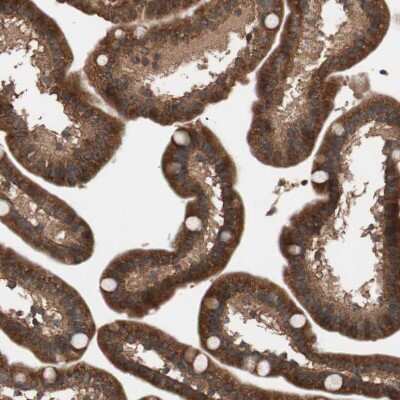 Immunohistochemistry-Paraffin: GLYCTK Antibody [NBP1-83292]