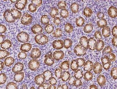 Immunohistochemistry-Paraffin: GLYCTK Antibody [NBP3-12587]
